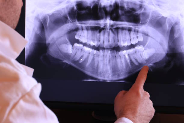 Best Emergency Broken Tooth Repair in Moorestown Lenola, NJ